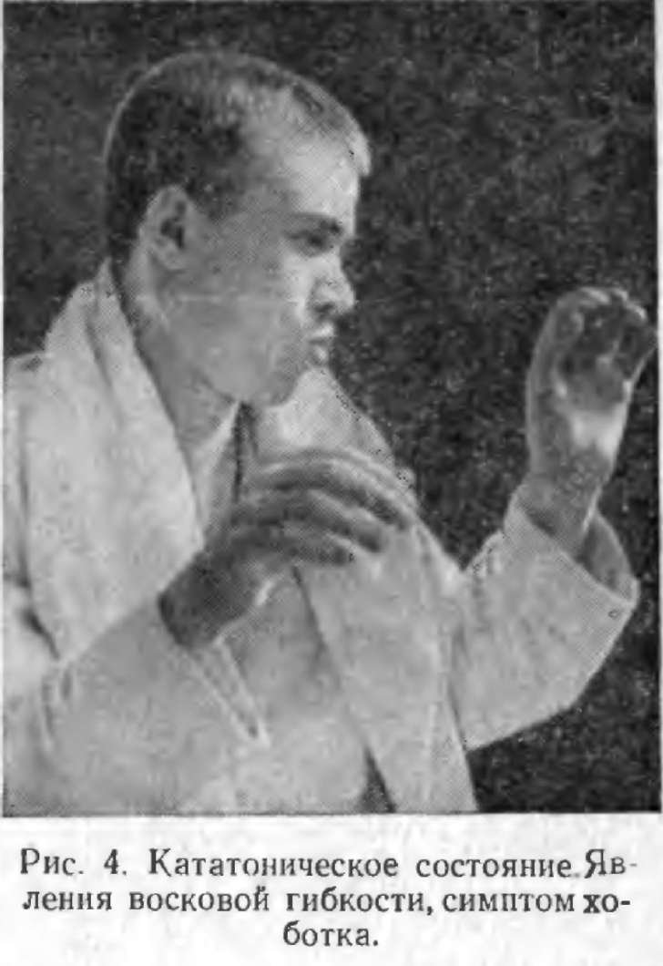 Кататонический синдром фото
