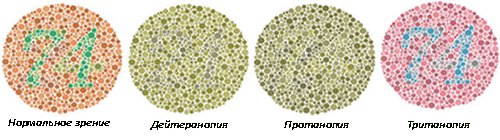 Путаю Желтый И Розовый Путаю желтый и розовый