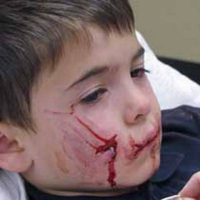 Майор поліції Руденко в Кривому Розі знущався із собаки: насадив на вила і хотів спалити, - зоозахисники - Цензор.НЕТ 5498