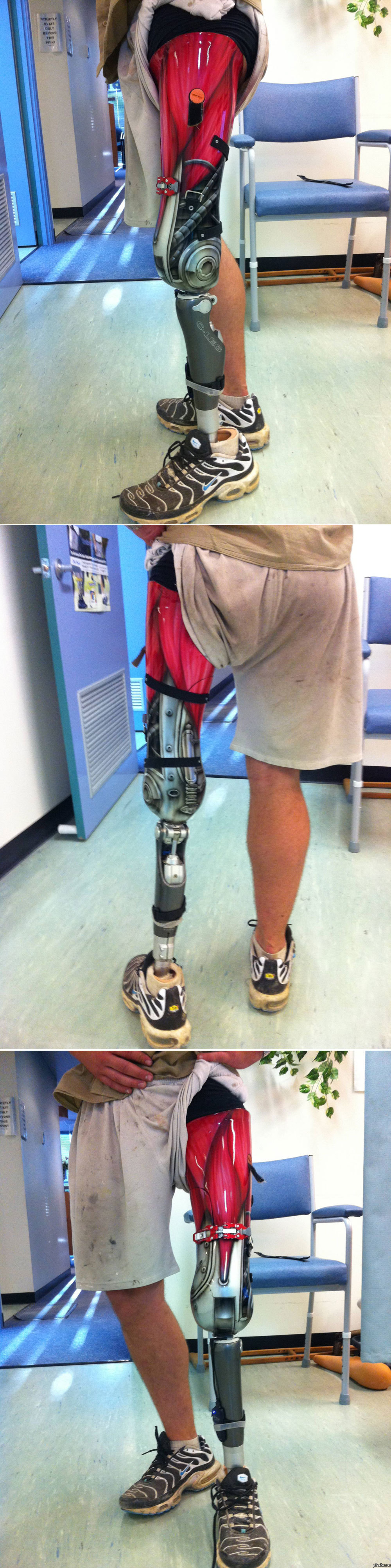 Самый дорогой протез. Бионический протез стопы. Бионический протез ноги. Механический протез ноги.