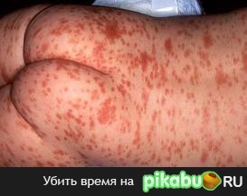 Плюсани если помнишь