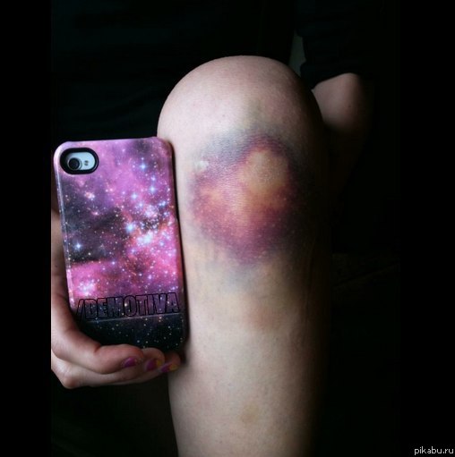 Живописная травма