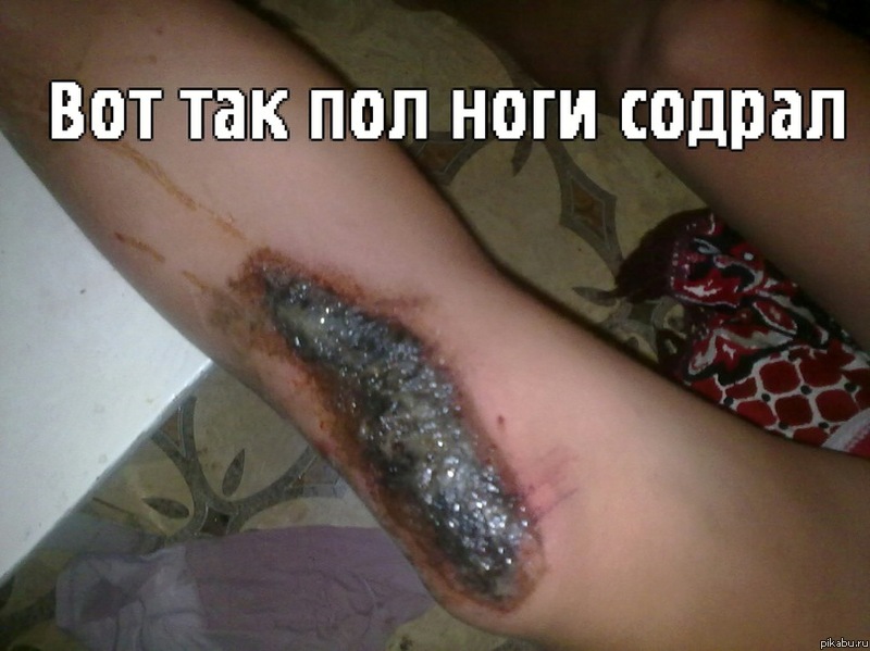 ���?!...