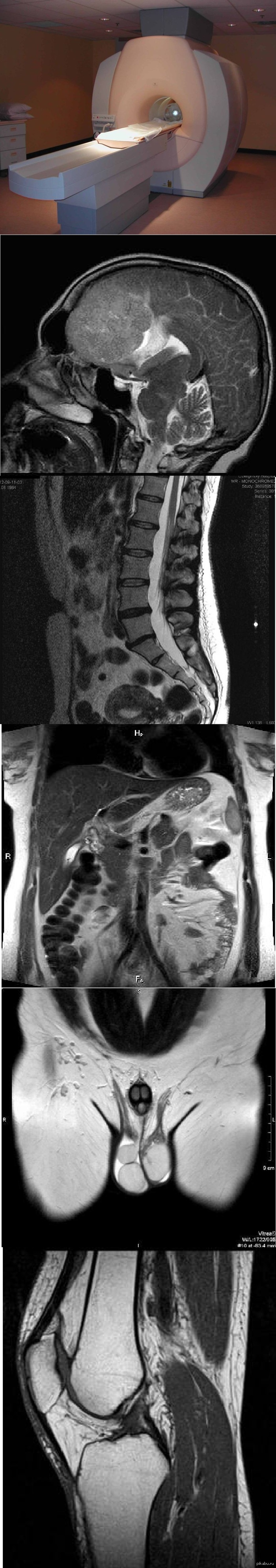 ��� ������.