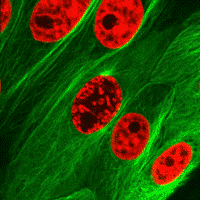   e  http://infinity-imagined.tumblr.com/post/37067427858/time-lapse-of-epithelial-cells-undergoing-mitosis