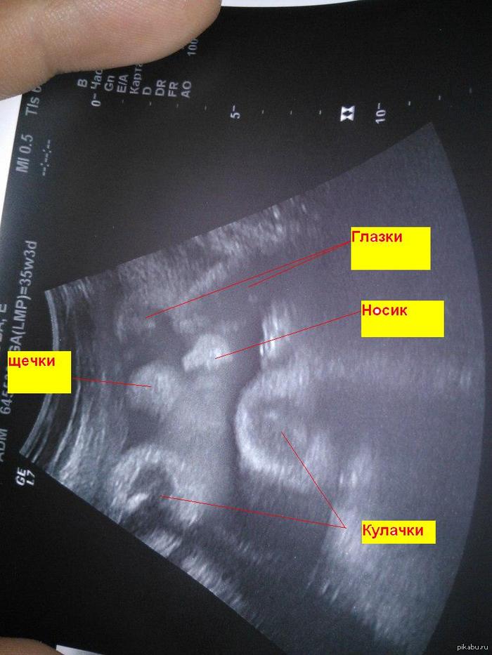 Моя лапость..