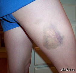 ��� ���������