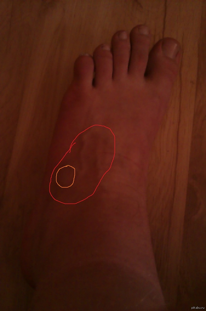 Есть разбирающиеся в медецине? =)