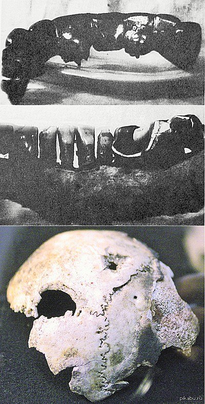 ��, ��� ��������