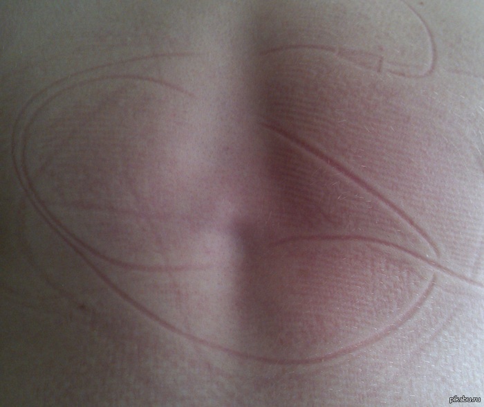 ��������!