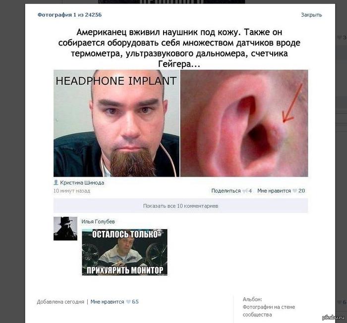 Американец вживил наушник под кожу | Пикабу
