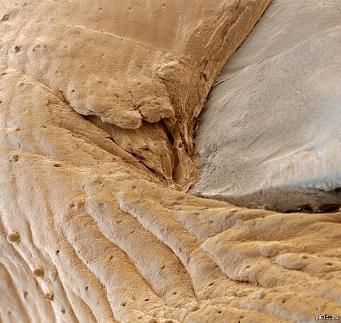 Грибок ногтей под микроскопом фото. Человеческий ноготь под микроскопом. Организмы под микроскопом. Как выглядят ногти под микроскопом. Как выглядят ногти под микроскопом.