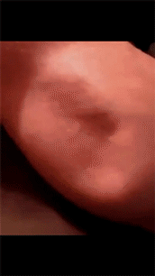 Это больно, наверное...