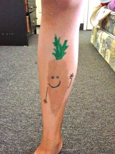 Не нравится родимое пятно?