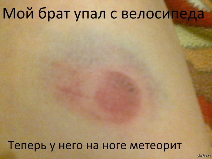 Удачно поцарапался