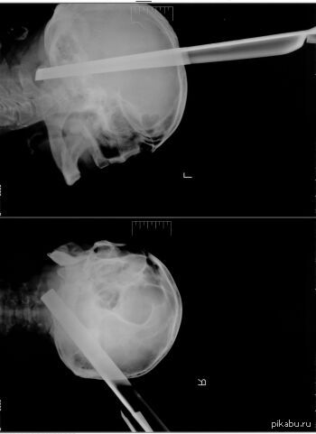 ����� �������� �� ������ ���������� ����� ��������