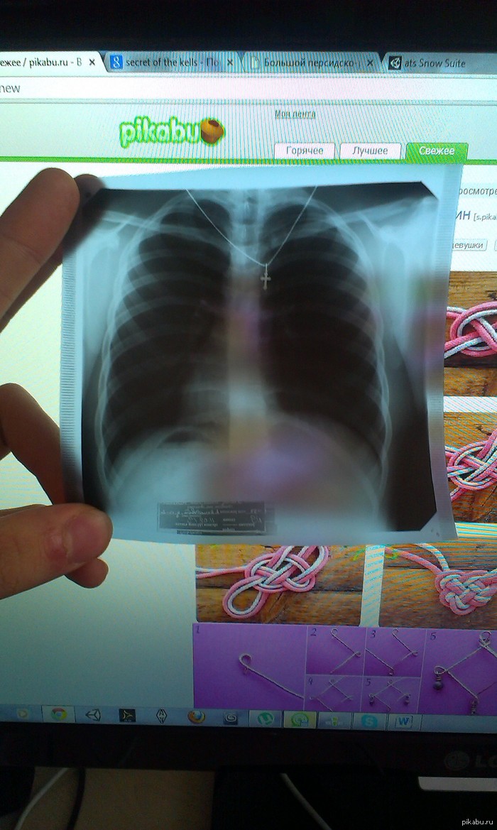 Святой рентген