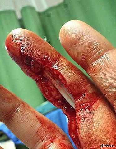 Cut the meat, damn it! - NSFW, Finger, Dismemberment