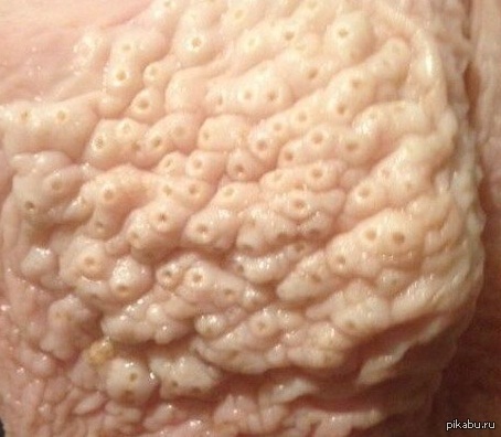 A little gesture. Who can guess what it is? - NSFW, My, Trypophobia, Mystery, Yummy