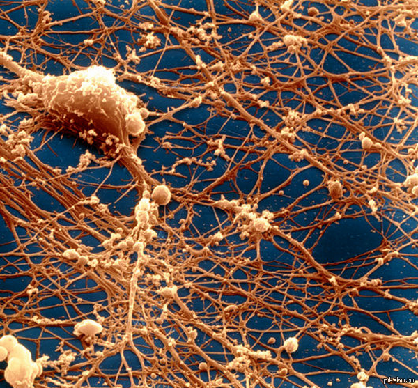 Новые клетки мозга. Нейроны мозга под микроскопом. Аксон нейрона микрофотография. Нейронная клетка под микроскопом. Нейрон клетка головного мозга.