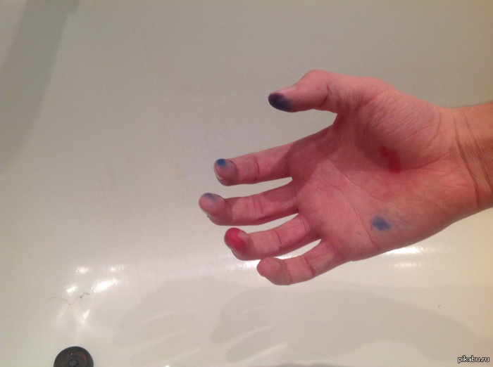 Я был достаточно коварен чтобы спереть из аптечки шприцы, но недостаточно умен чтобы спереть еще и перчатки.