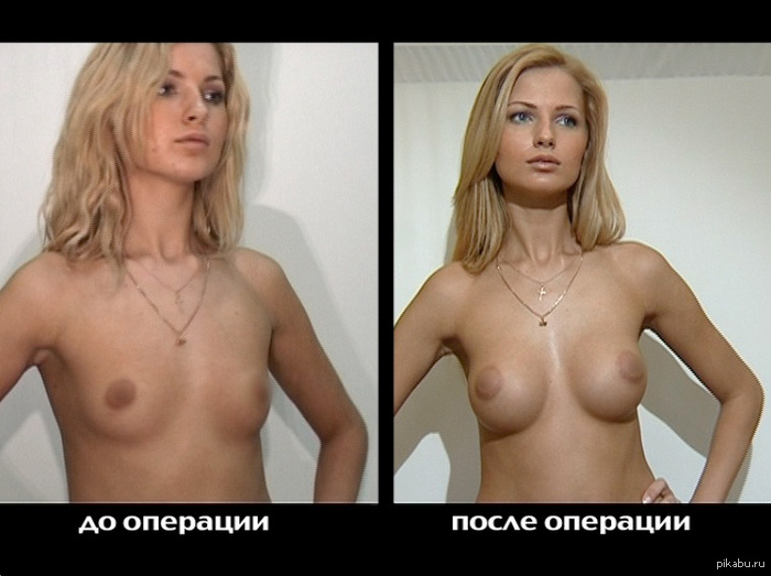 What are you for? Small and their own or large but can be made? Interesting - NSFW, Breast, Girls, Plastic surgery