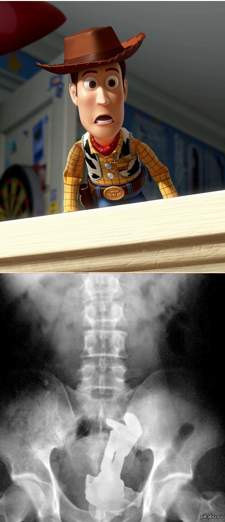 Buzz where are you? - The history of toys, Toys, X-ray, Humor, The photo
