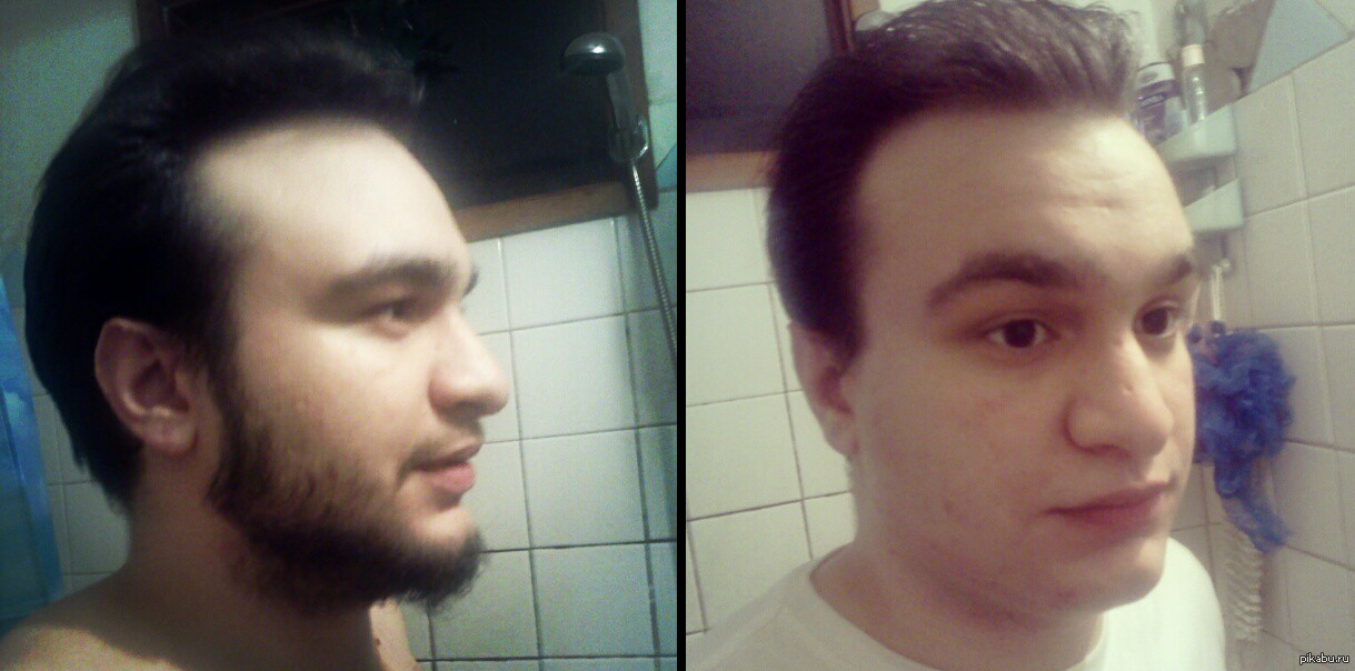 Плохо бреет. Не брился 2 месяца. 2 Месяца без бритья. Неудачно побрился фото.