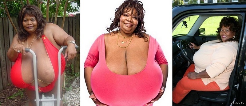 Фото: Самая большая в мире грудь растет на 2,5 см в месяц