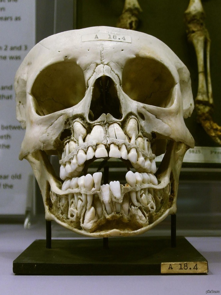 Коренные зубы вторым. Рентген черепа ребенка коренные зубы. Рентген черепа с молочными зубами.