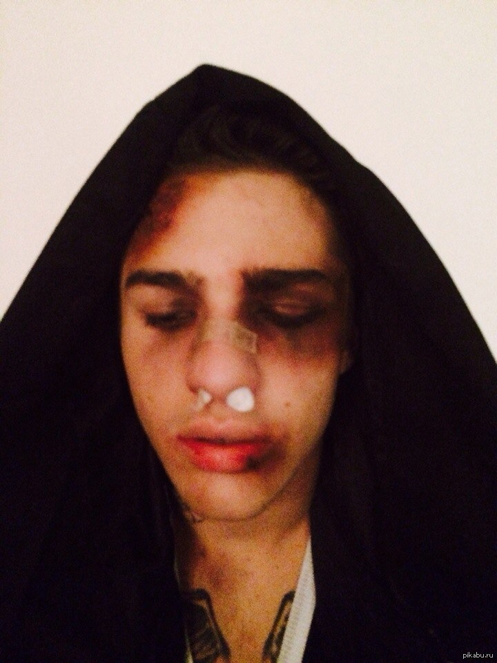 Хейтеры Желудя пляшут и поют. | Пикабу