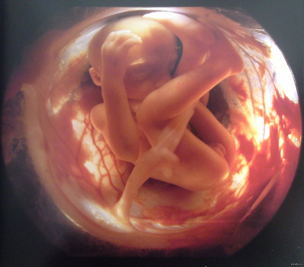 Плод 14 недель беременности фото как выглядит